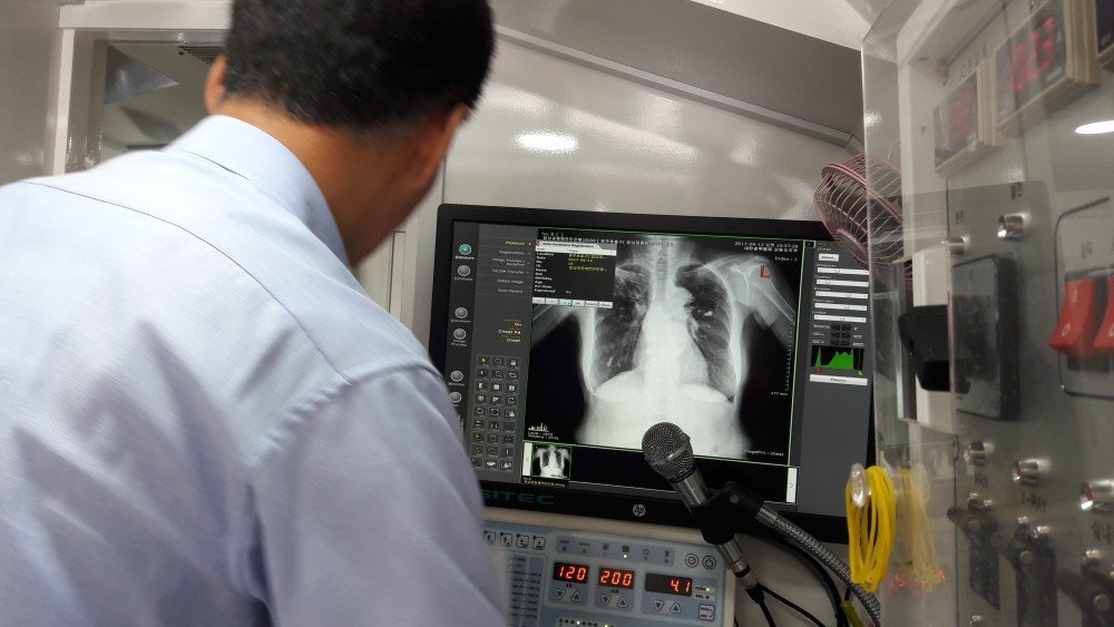 20170912_104349 (4) 흉부엑스선검사.jpg